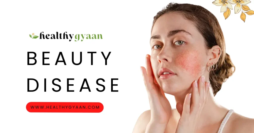 Beauty Disease