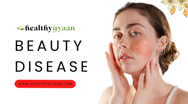 Beauty Disease