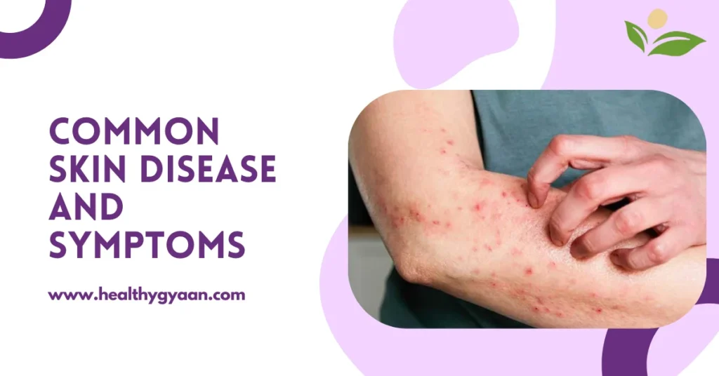 Common skin disease and symptoms