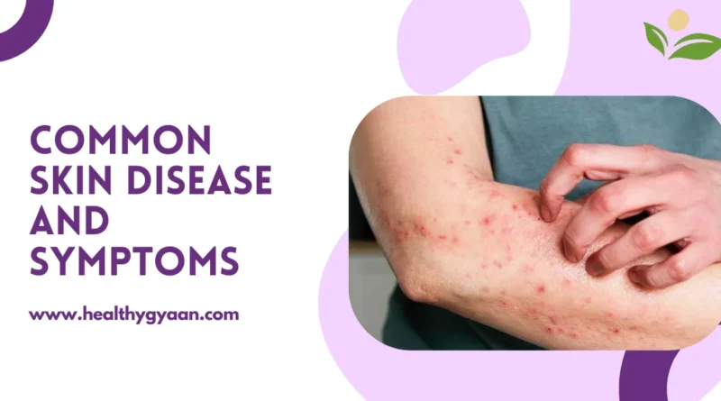 Common skin disease and symptoms