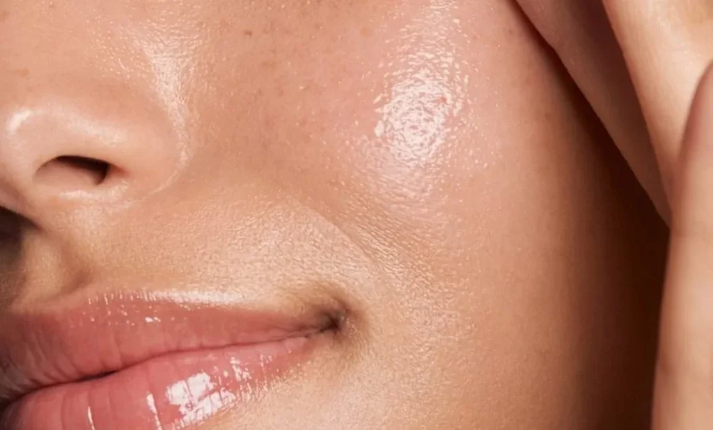 Oily skin