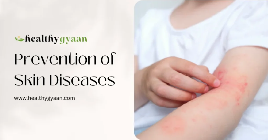 Prevention of skin diseases