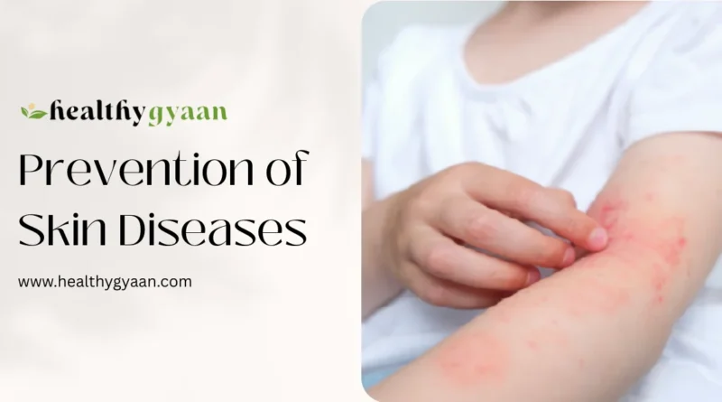 Prevention of skin diseases