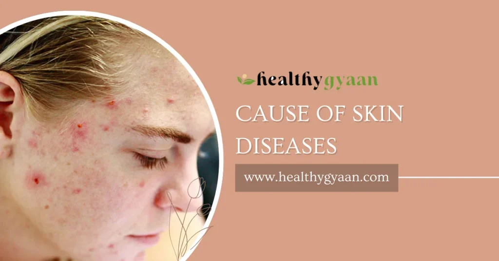 cause of skin diseases