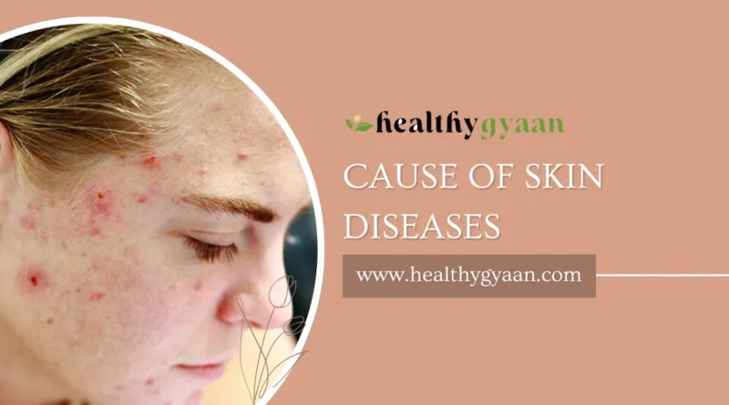 cause of skin diseases