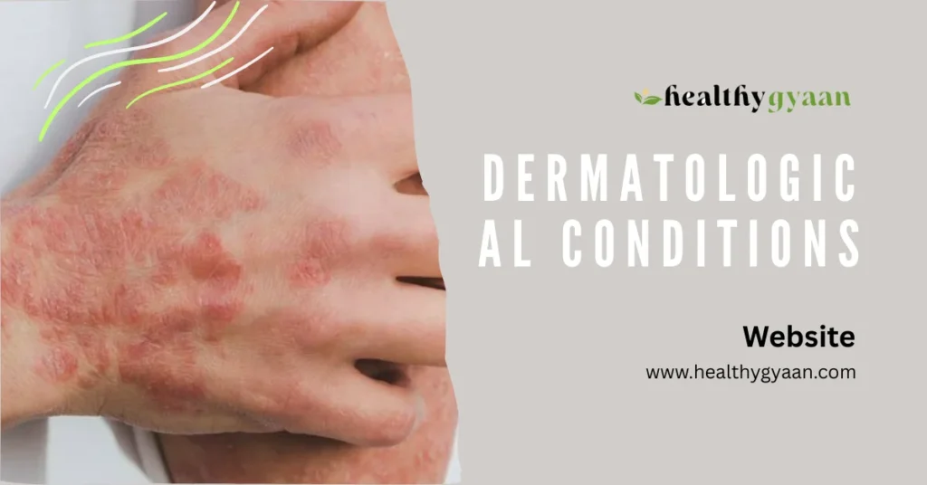 dermatological conditions