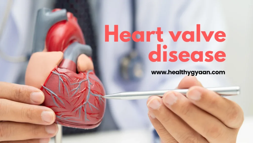 Heart valve disease