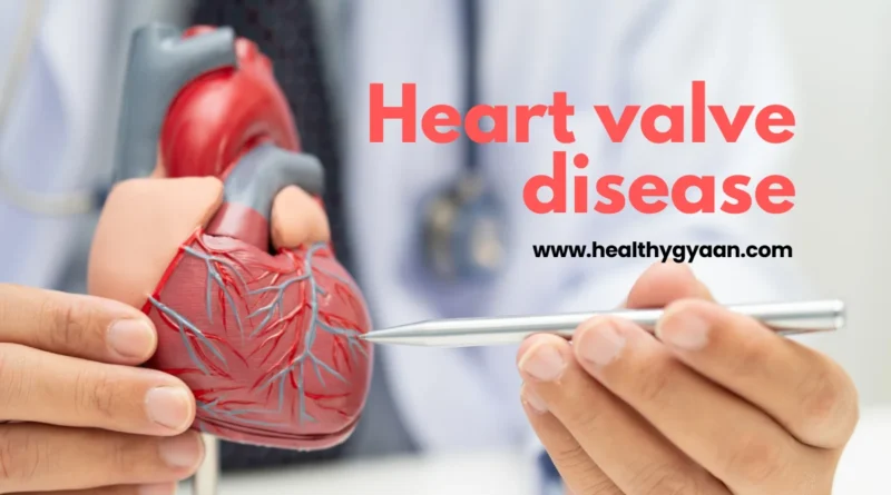 Heart valve disease
