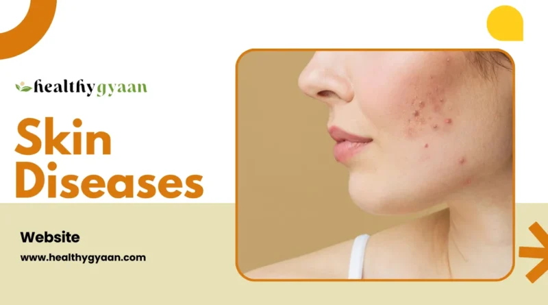 skin diseases