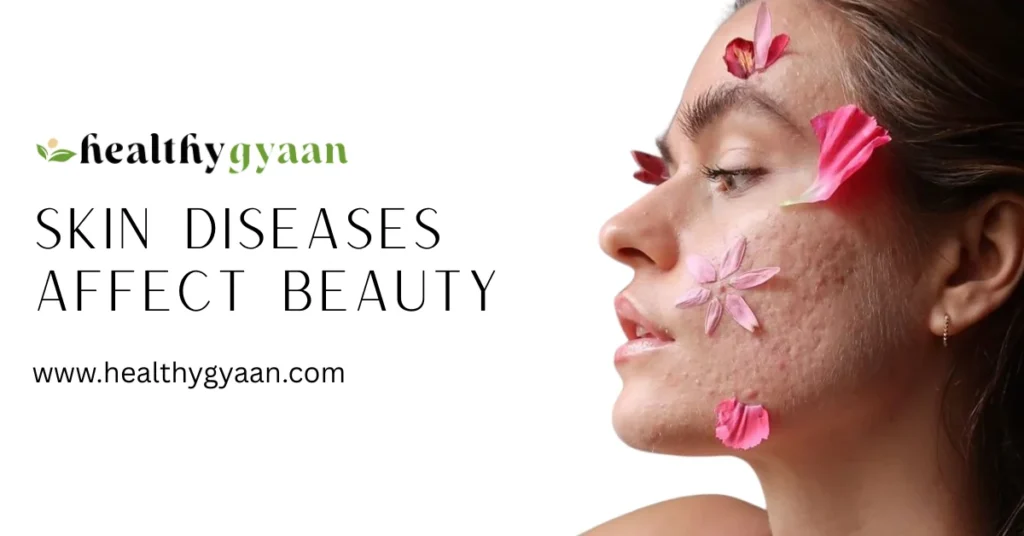 ​Skin Diseases Affect Beauty