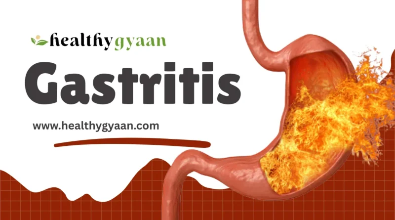 Gastritis