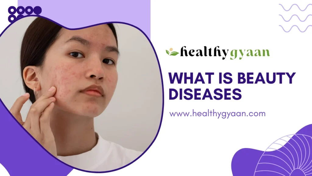 What is Beauty Diseases