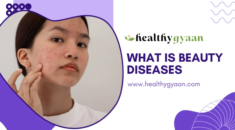 What is Beauty Diseases