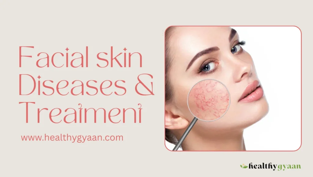 facial skin diseases and treatment