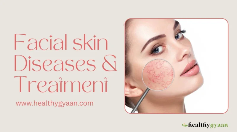facial skin diseases and treatment