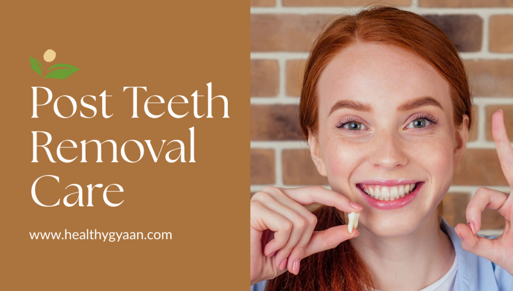 post teeth removal care