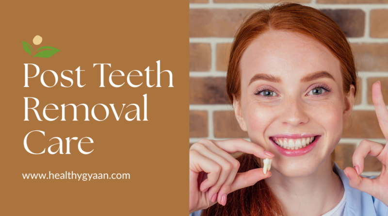 post teeth removal care