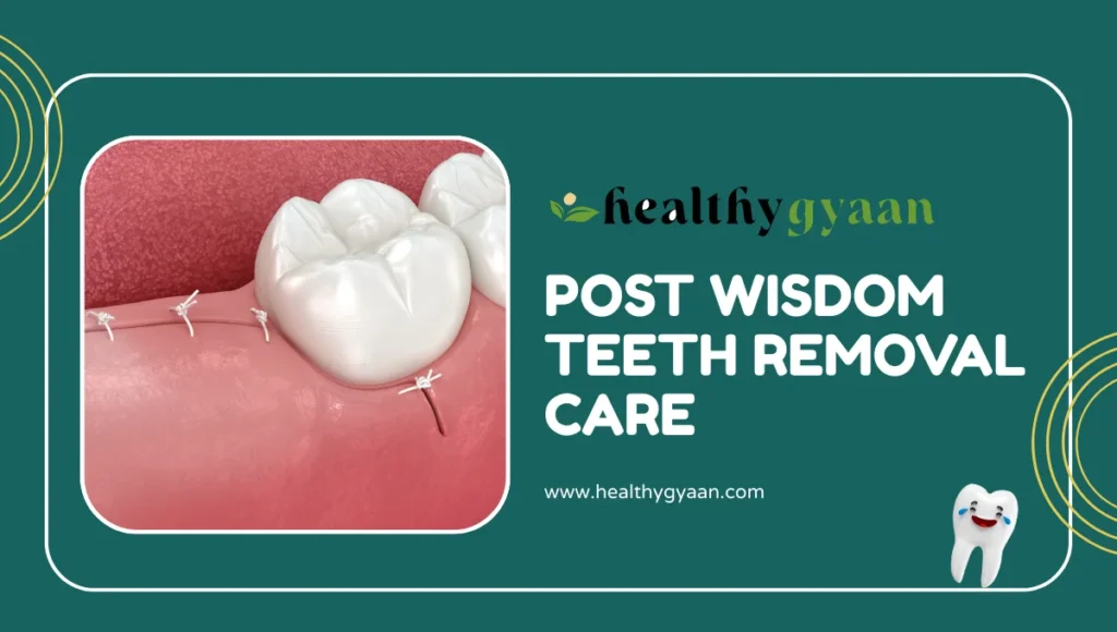post wisdom teeth removal care