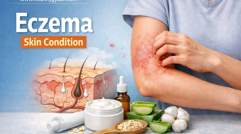 ​Eczema skin condition
