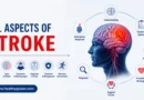 All aspects of stroke