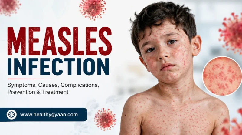 Measles infection